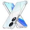  Techsuit - Ütésálló átlátszó szilikon tok - Honor X7b / X7b 5G-5949419087231 2 kép