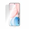  Intelligens Védelem - Prémium Klasszikus (2 csomag) - Honor 400 - �-5949419318748 2 kép