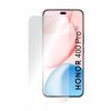  Okos Védelem - Prémium Klasszikus (2 darabos) - Honor 400 Pro - Át-5949419318731 2 kép